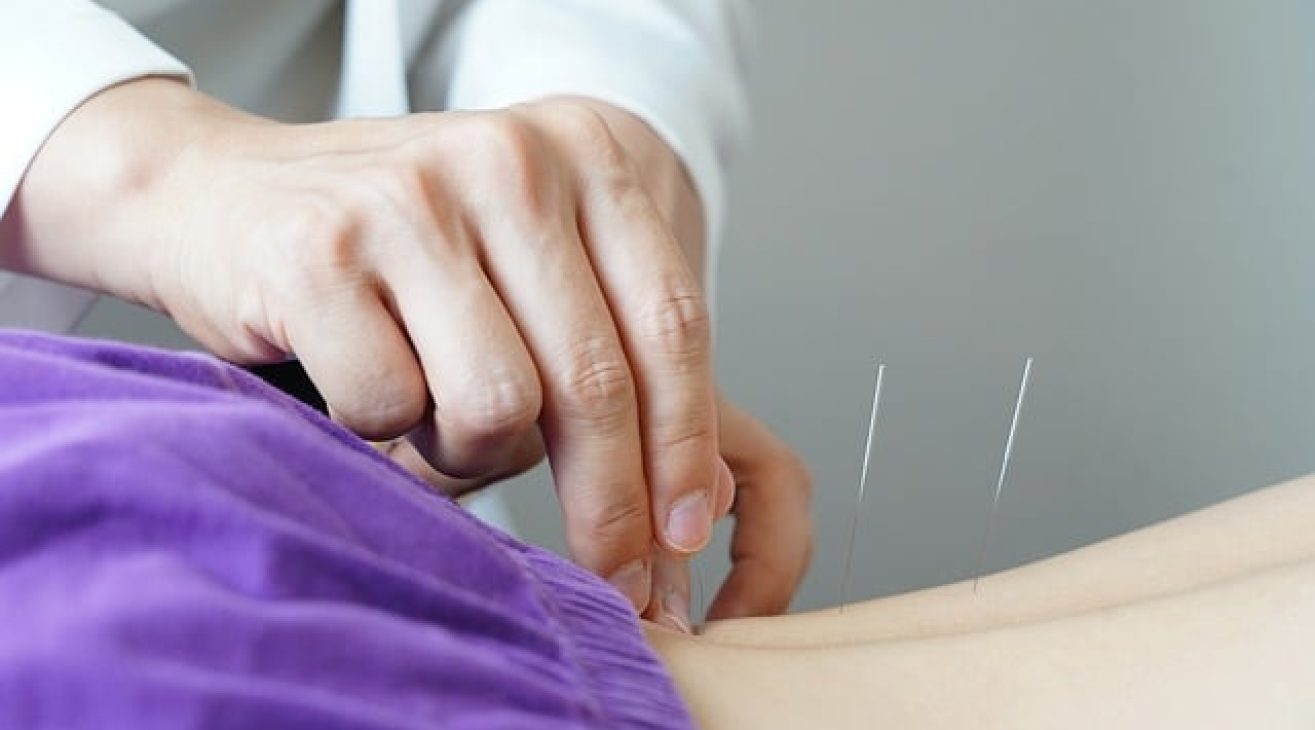 Acupuntura: equilíbrio natural para corpo e mente