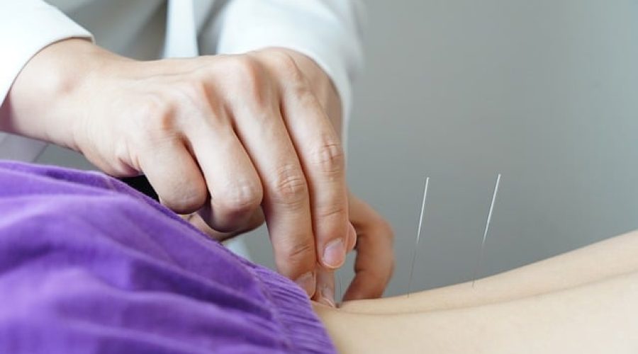 Acupuntura: equilíbrio natural para corpo e mente